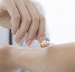 Dokter jono bedah indramayu perawatan luka fisioterapi