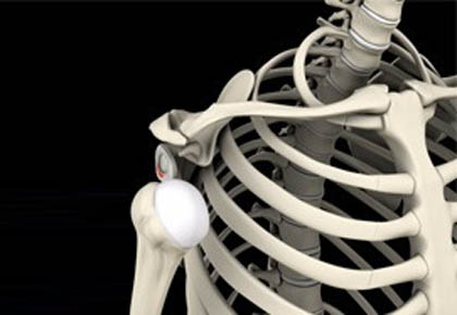 Dokter jono bedah indramayu perawatan luka fisioterapi